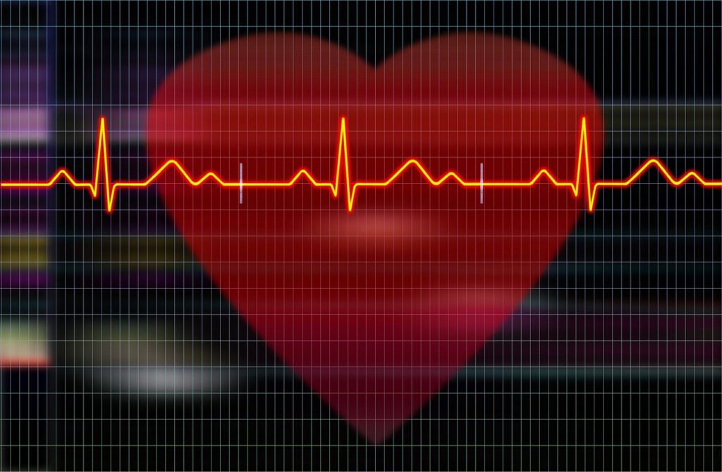 cardiogram