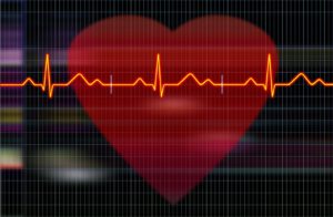 cardiogram