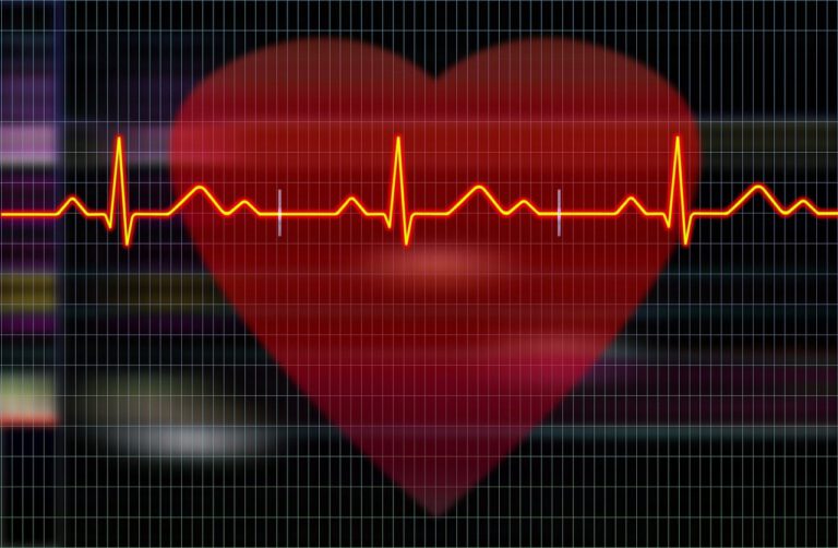 cardiogram